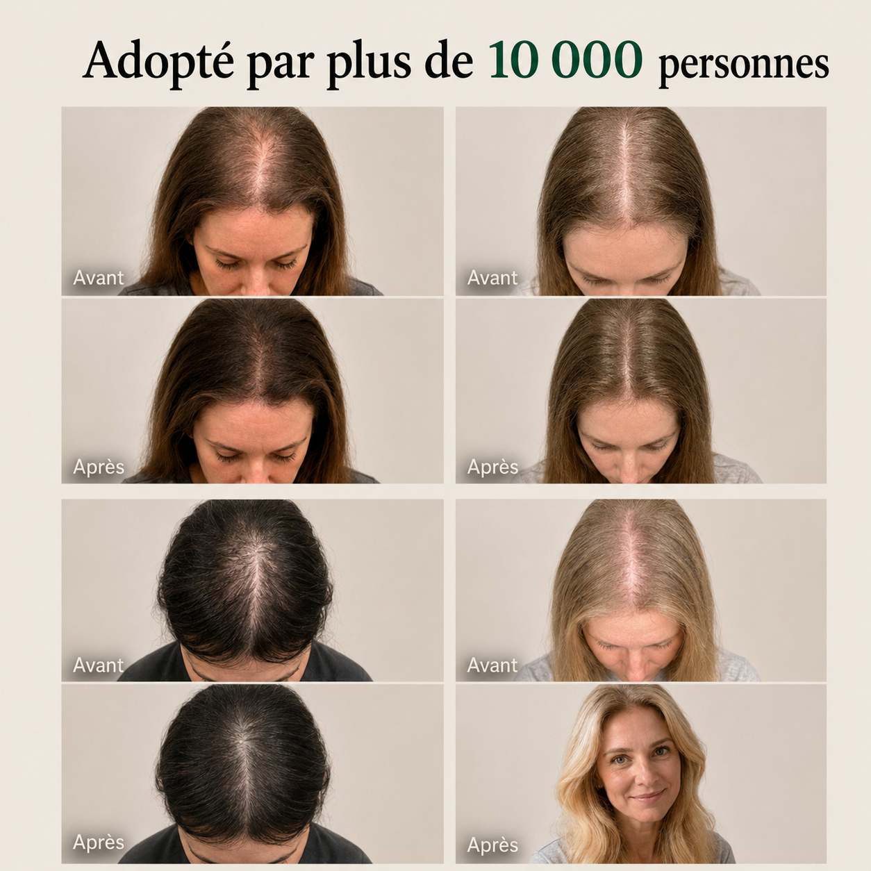 Savon Coréen Revitalisant Cuir Chevelu pour Femme — 12 Herbes Fermentées